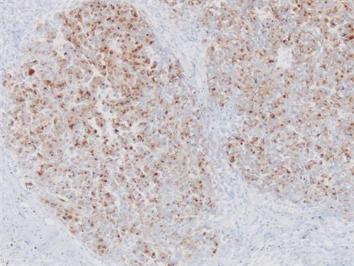 3370A | Control Slides:Immunopathology; HMB-45